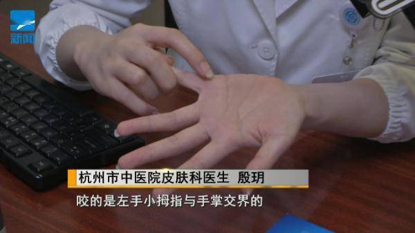 本年首例！杭州伯父去河滨洗手，成果被紧迫送医…